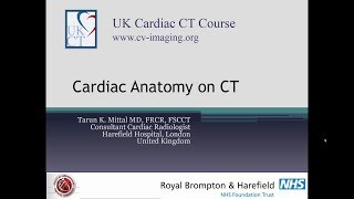 Cardiac anatomy on CT - Part A