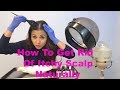 How To Get Rid Of Itchy Scalp &amp; Dandruff Naturally With A Hair Steamer