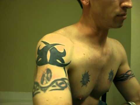 Tattoo removal with TCA episode 2.MP4 - YouTube