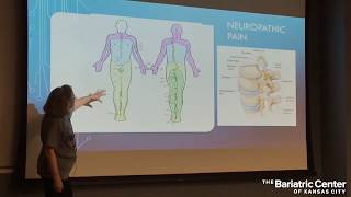 Alternatives to NSAIDs to Treat Pain