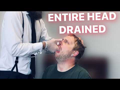 THE HAWK TUA Chiropractic TECHNIQUE* RARE Sinus Therapy. Gut & Skull Drained For Relief. thumbnail