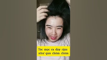 Dầu gội thảo dược kích mọc tóc DHT