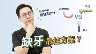 選擇最適合你的假牙：活動假牙、牙橋、植牙比一比