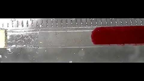 BLOOD PLASMA SEPARATION