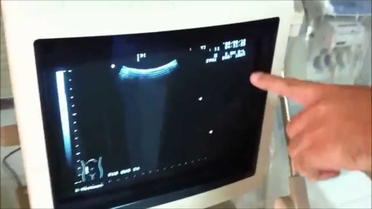 ALOKA SSD-1000 Mode  part 3