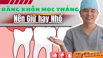 Răng Khôn Mọc Thẳng Nên Giữ Hay Nhổ