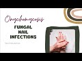 Onychomycosis - Fungal NAIL infections