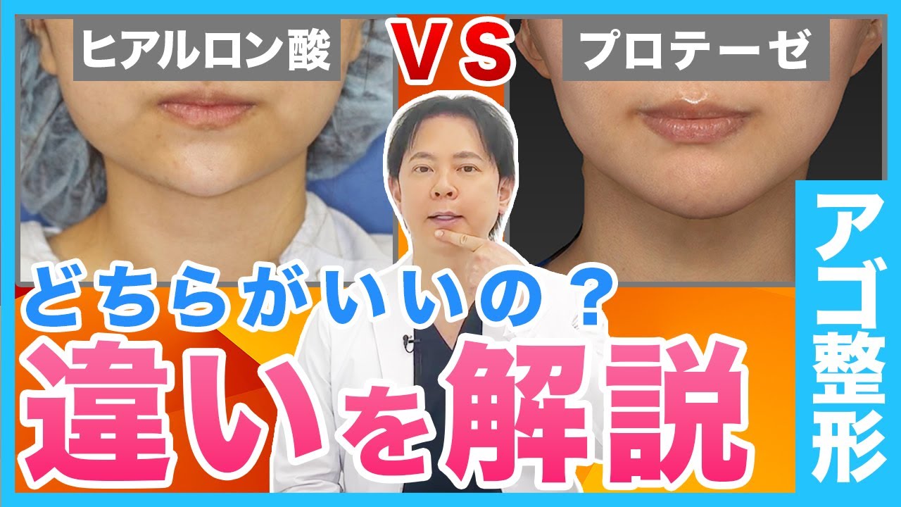 アゴの形を整えるならヒアルロン酸とプロテーゼどちらを選ぶべきか徹底解説