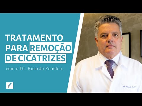 Vídeo: Tratamento De Cicatrizes Atróficas: Cascas, Enchimentos E Muito Mais