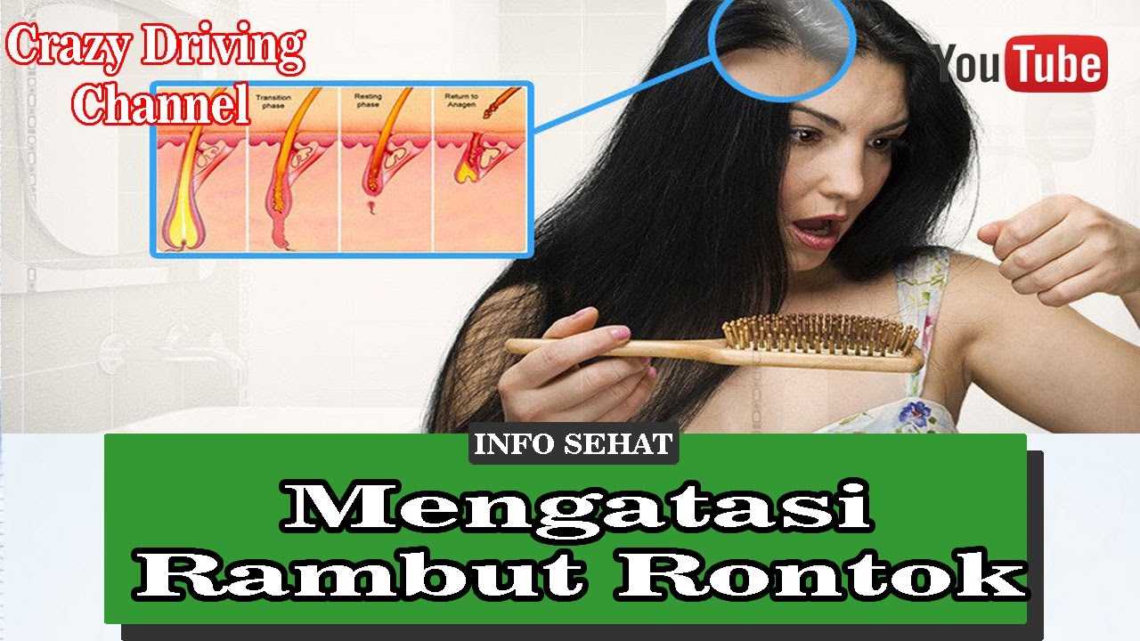 Rambut Anda Rontok Coba Cara Ini Untuk Mengatasinya YouTube