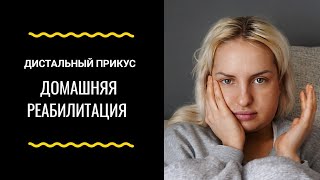 Дистальный прикус. Восстановление после операции. Часть 3