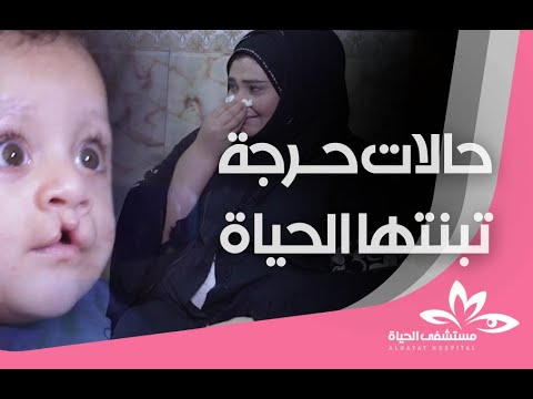 حالات حرجة تبنتها مستشفى الحياة في برنامج من الواقع مع علي عذاب 