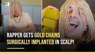 Gold hair Mexican rapper goes viral after getting gold chain hooks  implanted into scalp  Trending NewsThe Indian Express