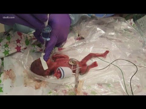 Video: Hva er den tidligste babyen som kan overleve utenfor livmoren?