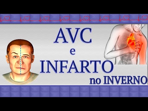 Vídeo: Qual é A Diferença Entre Um AVC E Enfarte Do Miocárdio: Qual é A Diferença, O Que é Mais Perigoso