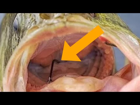 easiest fishing hook to remove Fishhook Removal