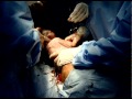 Cesarean childbirth