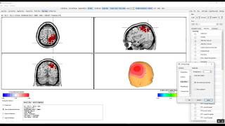 EEG Intro to NeuroNavigator Normative Database EEG Intro to NeuroNavigator Normative Database