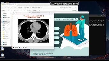 Lung Cancer Prediction using Machine Learning | Python Projects for Resume