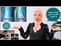 طريقه غسيل و ازاله البقع من ملابس الستان و الحرير مع إنجي المصري Fashion 101