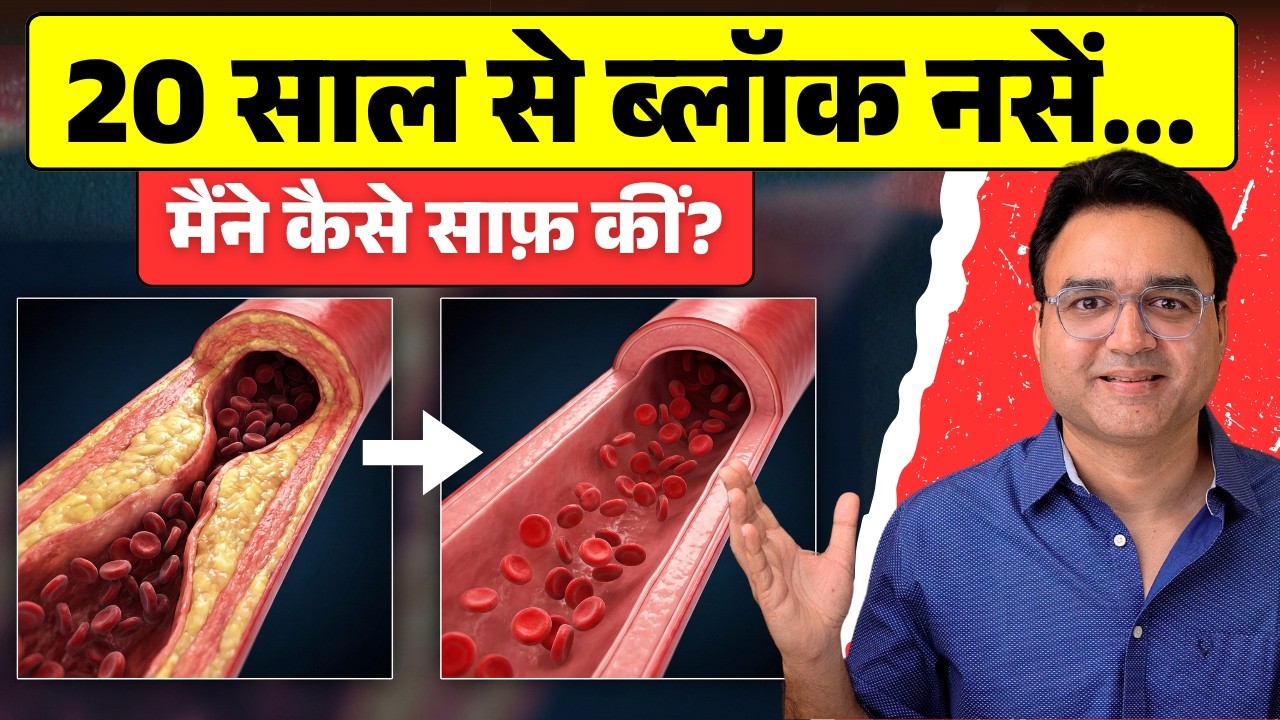 20 साल पुरानी Blockage मैंने कैसे Reverse की? 😱 | Clear Your Clogged Arteries 