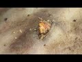 [ASMR] Sharp Ingrown Trimmed! Professional Pedicure DR LEE’S ULTIMATE ZITPOPPER 1909M2IMG 0382