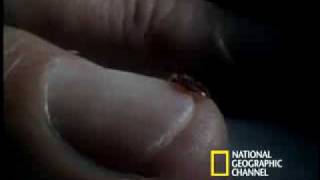 Bed Bugs حشرة البق القذرة.wmv Bed Bugs حشرة البق القذرة.wmv