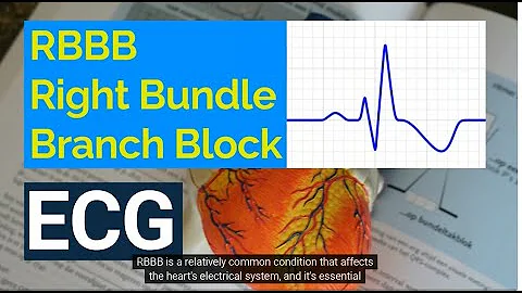 Understanding Right Bundle Branch Block (RBBB) on ECG:  Causes, Symptoms, and Treatment.
