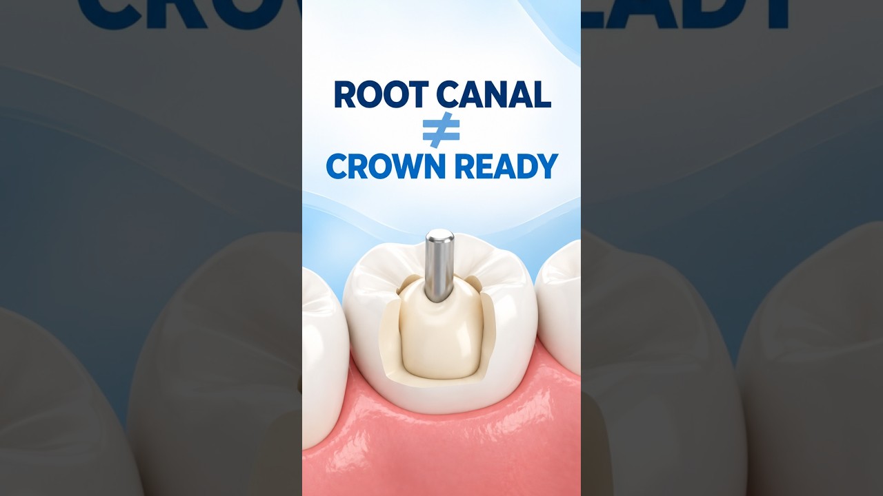 Root Canal Done? 🦷 Do You Need a Post & Core Before a Crown? | Smile Zone Bangalore