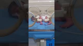 Incubator newborn baby unhealthy this baby unwant environment newborn baby