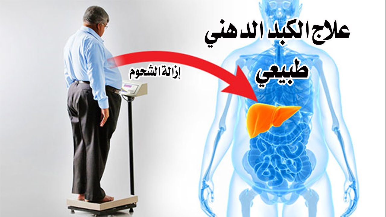 ملكية كمان نابير  طريقة ازالة شحم دهون الكبد | علاج الكبد الدهني طبيعيا - YouTube