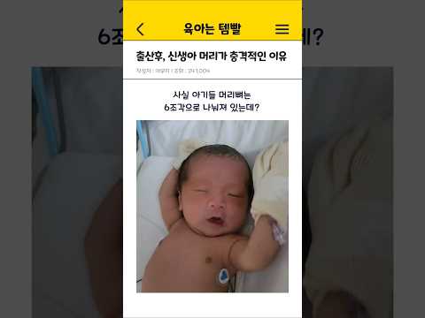 출산후 신생아 머리가 충격적인 <strong>이유</strong> [아기 육아 <strong>상식</strong>]