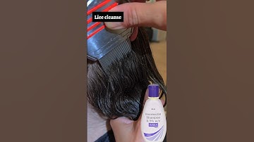 Lice & nits treatment | Best Lice Comb for Easy Removal! 🪮✨  #liceremoval #licetreatment#piojos