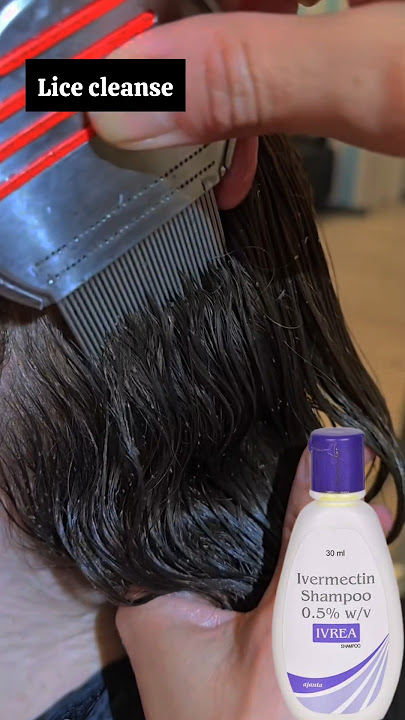Lice & nits treatment | Best Lice Comb for Easy Removal! 🪮✨  #liceremoval #licetreatment#piojos