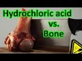 Hydrochloric Acid vs. Bone total decomposition 🍖