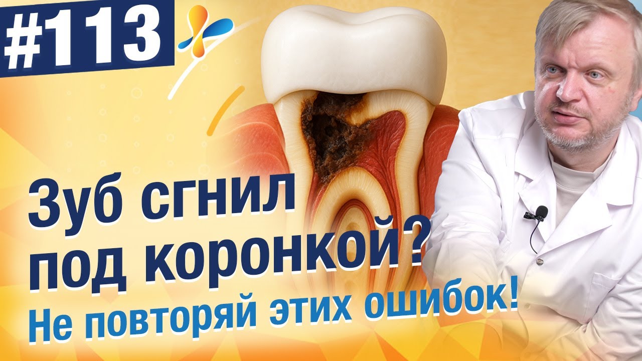 Зубы под коронкой гниют? Что делать, чтобы зуб под коронкой не разрушился?