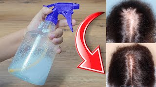 Tu Cabello no se volverá a Caer y Crecerá mucho desde que le apliques esto