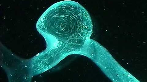 Cerebral aneurysm flow visualization