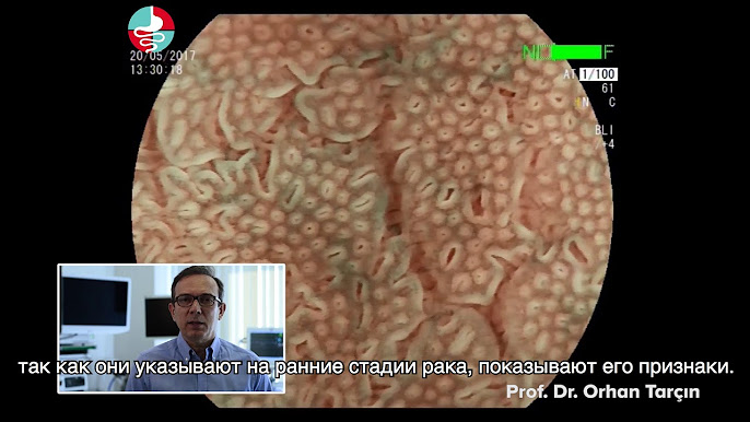 Форум: Күйеуі достарымен әйелін трахает Intimissimi акциясының көтерме саудасы