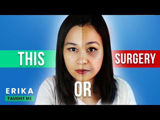 Dr. Anthony Youn: Get A Younger Face Without Surgery! class=