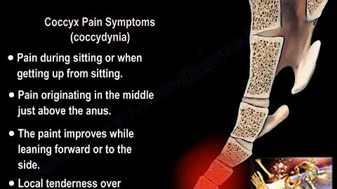 Coccydynia , coccyx pain - Everything You Need To Know - Dr. Nabil Ebraheim - DayDayNews