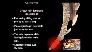 Coccydynia , coccyx pain - Everything You Need To Know - Dr. Nabil Ebraheim