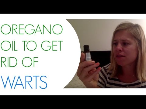 Warts Are Gross! Get Rid of Them with Oregano Oil :) Hooray for Natural Remedies!