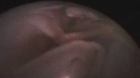 The dependence video documentacion