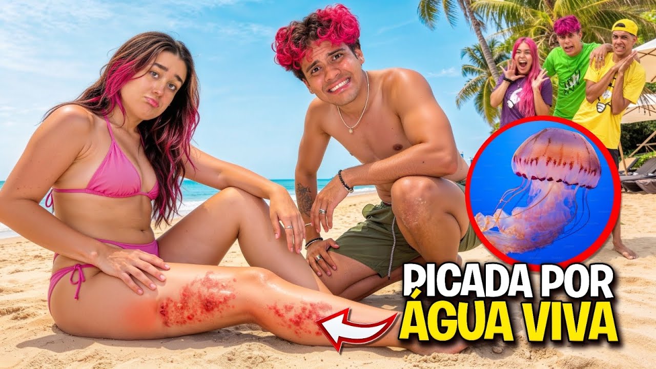 ERA PRA SER UM DIA DE PRAIA *Emilly foi queimada