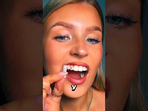 Míralo entero antes de hacerte un tatuaje en los dientes… #shorts