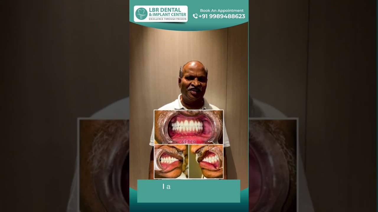 Zygomatic Implants in India: Revolutionary Dental Solution!