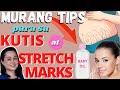 Baby Oil Para sa Kutis at Stretch Marks - by Doc Liza Ramoso-Ong