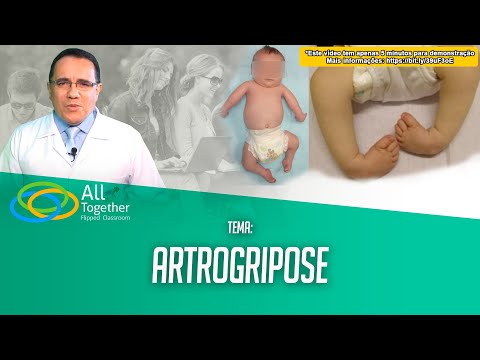 Vídeo: Você pode andar com artrogripose?