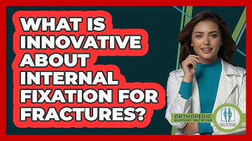 What Is Innovative About Internal Fixation For Fractures? - Orthopedic Support Network